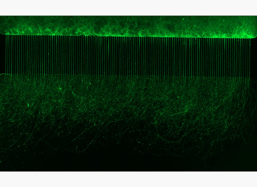Representative imaging output 3 from Ananda Devices' platforms