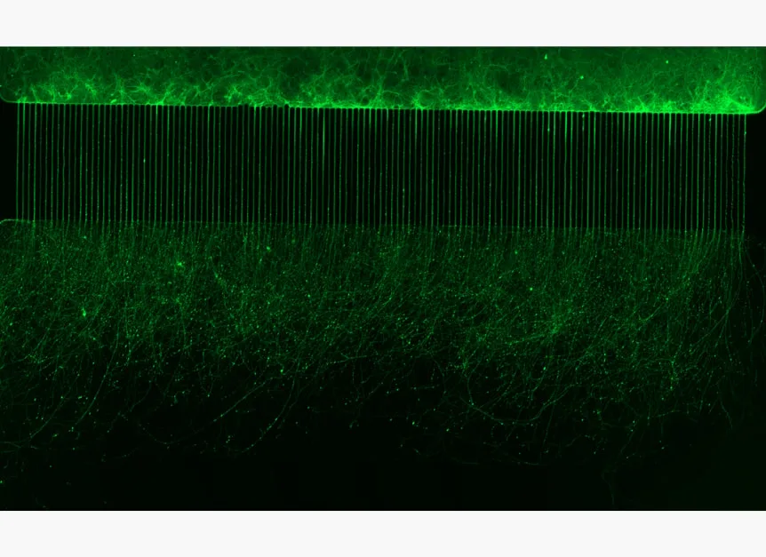 Representative imaging output 3 from Ananda Devices' platforms